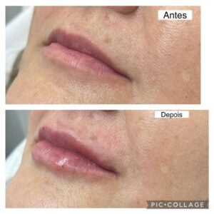 WhatsApp Image 2026-01-15 at 20.30.22